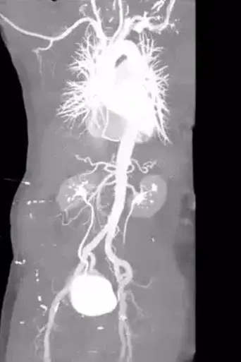 X-Ray Eros